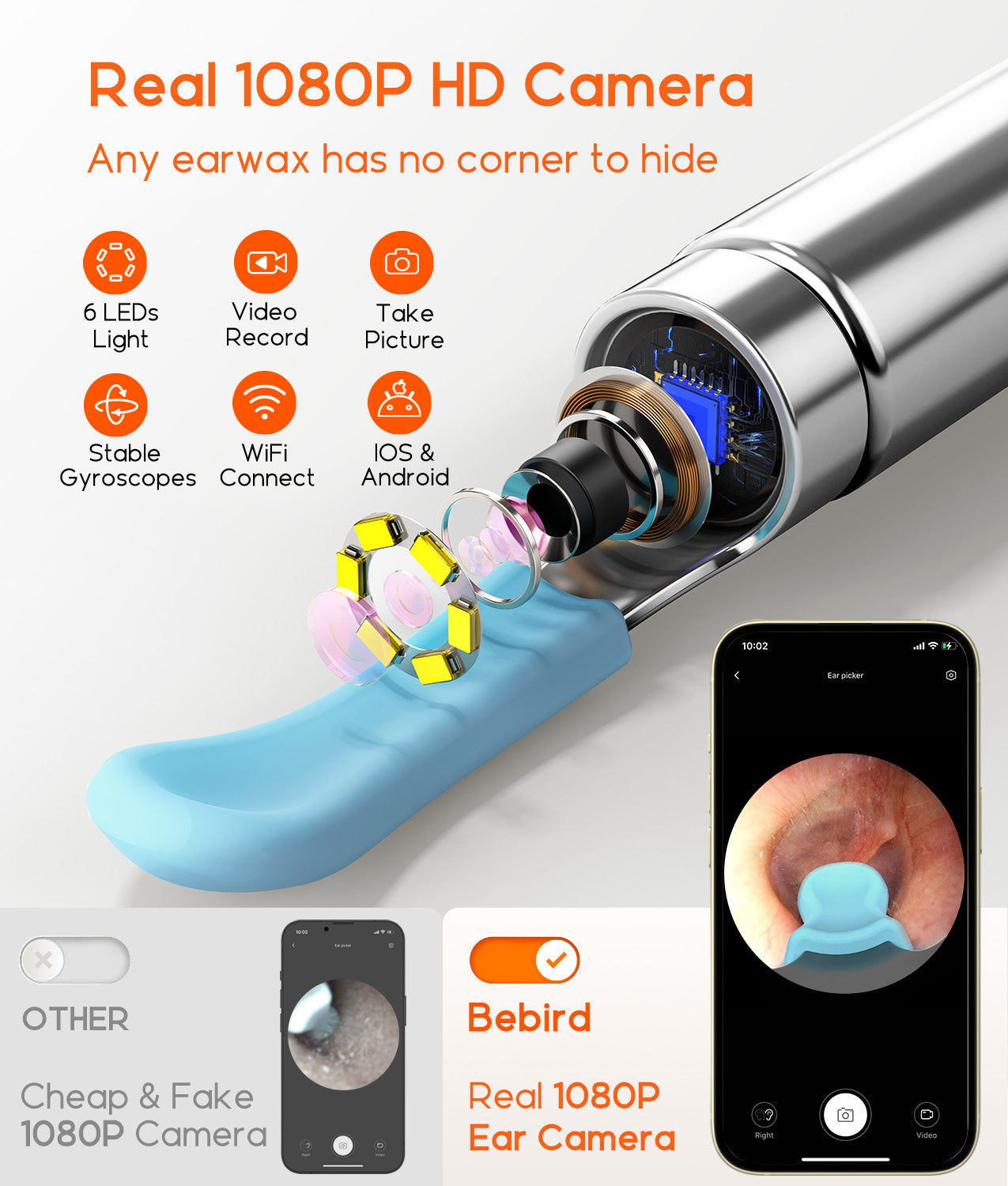 Bebird R1 Health Care AI Recognition of External EarCanal Ear Cleaners with Cameras